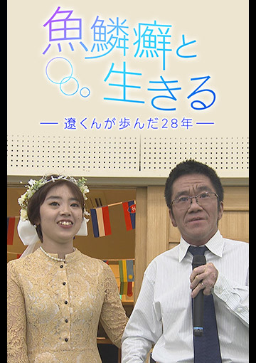 魚鱗癬と生きる ー遼くんが歩んだ28年ー